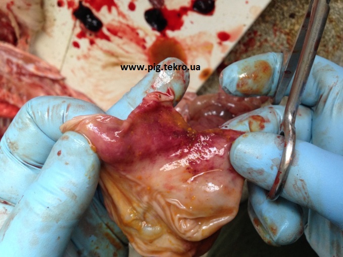 Gemoragіchnij gastrit