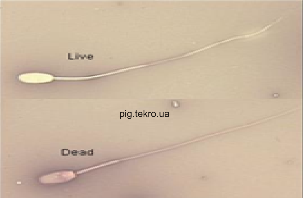 Vigljad spermіїv pіd mіkroskopom pіslja farbuvannja eozinom