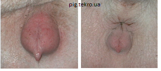 Vulva svinomatki pіd chas stadії zbudzhennja zlіva stadії galmuvannja sprava