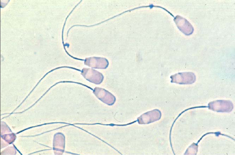 Citoplazmatichna kraplja