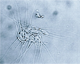 Zіrchasta agljutinacіja spermіїv knura